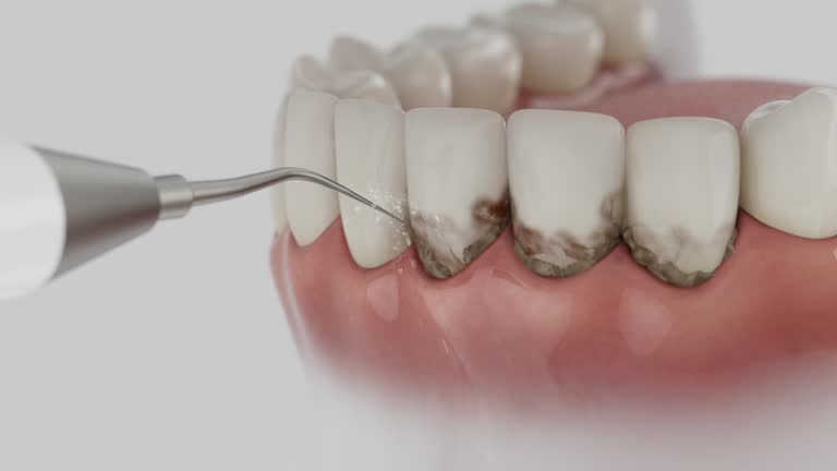 Trusted Tooth Extraction service in Port Allen, LA - Dentist Open Now